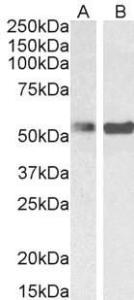 Anti-PTBP1 Antibody (A83482) (01-03 µg/ml) staining of Mouse Ovary (A) and Rat Ovary (B) lysate (35 µg protein in RIPA buffer) Primary incubation was 1 hour Detected by chemiluminescence