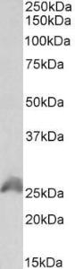 Anti-HOXB6 Antibody (A85148) (1 µg/ml) staining of HEK293 lysate (35 µg protein in RIPA buffer). Primary incubation was 1 hour. Detected by chemiluminescence