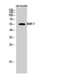 Antibody anti-BMP-7 100 µg