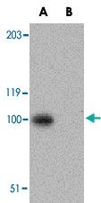 Anti-NPHS1 Rabbit Polyclonal Antibody