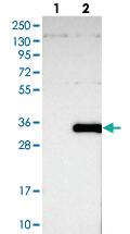 Anti-THAP6 Rabbit Polyclonal Antibody