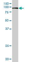 Anti-VIL1 Rabbit Polyclonal Antibody