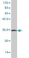 Anti-TFF3 Mouse Monoclonal Antibody [clone: 3D9]