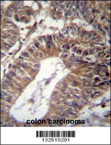 Anti-GCC1 Rabbit Polyclonal Antibody (HRP (Horseradish Peroxidase))