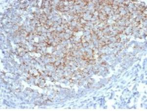 Immunohistochemical analysis of formalin-fixed, paraffin-embedded human tonsil using Anti-Interferon alpha 1 Antibody [IFNA/6689] at 2 µg/ml in PBS for 30  minutes at room temperature