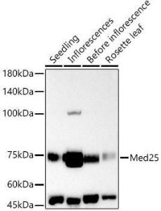 Western blot analysis of extracts of various tissues from Arabidopsis thaliana, using Anti-MED25 Antibody (A305325) at 1:1,000 dilution. The secondary antibody was Goat Anti-Rabbit IgG H&L Antibody (HRP) at 1:10,000 dilution.