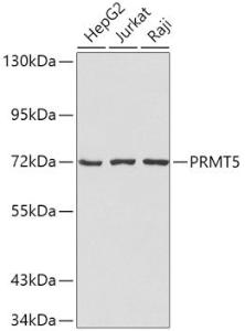 Western blot analysis of extracts of various cell lines, using Anti-PRMT5 Antibody (A9029). The secondary antibody was Goat Anti-Rabbit IgG H&L Antibody (HRP) at 1:10,000 dilution. Lysates/proteins were present at 25µg per lane. The blocking buffer used was 3% non-fat dry milk in TBST.