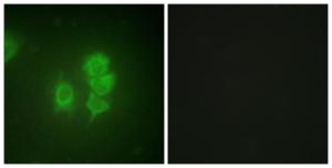 Immunofluorescence analysis of HUVEC cells using Anti-MSK1 Antibody. The right hand panel represents a negative control, where the antibody was pre-incubated with the immunising peptide