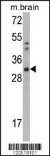 Anti-CAPZB Rabbit Polyclonal Antibody