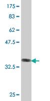 Anti-CFTR Mouse Polyclonal Antibody