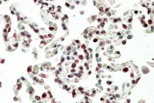 Anti-HOXB6 Antibody (A85148) (5 µg/ml) staining of paraffin embedded Human Lung. Steamed antigen retrieval with citrate buffer pH 6, AP-staining