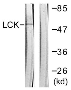 Anti-Lck Rabbit Polyclonal Antibody