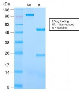 SDS-PAGE analysis of Anti-CD31 Antibody [C31/2876R] under non-reduced and reduced conditions; showing intact IgG and intact heavy and light chains, respectively. SDS-PAGE analysis confirms the integrity and purity of the antibody.