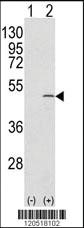 Anti-CAPZB Rabbit Polyclonal Antibody