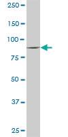 Anti-VIL1 Rabbit Polyclonal Antibody