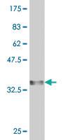 Anti-AMY1A Mouse Monoclonal Antibody [clone: 2D4]