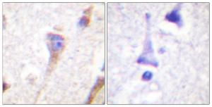 Anti-PKC mu Rabbit Polyclonal Antibody