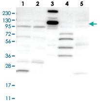 Anti-KIAA0753 Rabbit Polyclonal Antibody