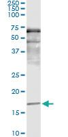 Anti-SNCA Antibody Pair