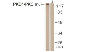 Anti-PKC mu Rabbit Polyclonal Antibody