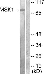 Western blot analysis of lysates from 293 cells, treated with UV 15' using Anti-MSK1 Antibody. The right hand lane represents a negative control, where the antibody is blocked by the immunising peptide