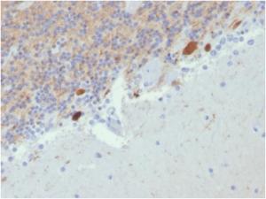 Immunohistochemical analysis of formalin-fixed, paraffin-embedded human cerebellum using Anti-Calretinin Antibody [CALB2/2807]