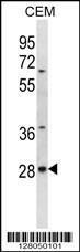 Anti-ALKBH4 Rabbit Polyclonal Antibody (HRP (Horseradish Peroxidase))