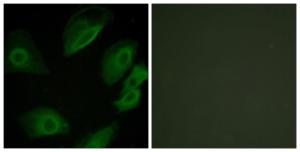 Immunofluorescence analysis of HeLa cells using Anti-Lck Antibody. The right hand panel represents a negative control, where the antibody was pre-incubated with the immunising peptide