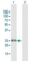 Anti-OIP5 Rabbit Polyclonal Antibody