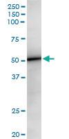 Anti-VIL1 Rabbit Polyclonal Antibody