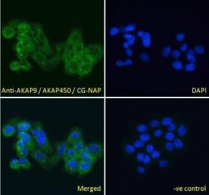 Anti-AKAP9 Antibody (A83483) Immunofluorescence analysis of paraformaldehyde fixed A431 cells, permeabilized with 0.15% Triton. Primary incubation 1hr (10µg/ml) followed by Alexa Fluor 488 secondary antibody (4µg/ml), showing cytoplasmic and Golgi apparatus staining.