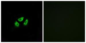 Immunofluorescence analysis of A549 cells using Anti-SCN7A Antibody The right hand panel represents a negative control, where the antibody was pre-incubated with the immunising peptide