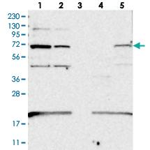 Anti-EEFSEC Rabbit Polyclonal Antibody