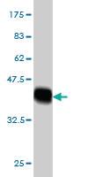 Anti-PIP4K2A Mouse Monoclonal Antibody [clone: 3A3]