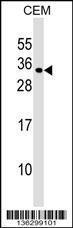 Anti-MXD1 Rabbit Polyclonal Antibody (AP (Alkaline Phosphatase))