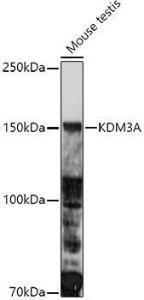 Western blot analysis of extracts of Mouse testis, using Anti-KDM3A/JHDM2A Antibody (A9035) at 1:1,000 dilution