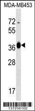 Anti-GFOD2 Rabbit Polyclonal Antibody (Biotin)