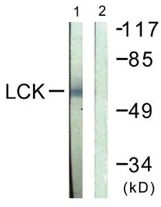 Western blot analysis of lysates from Jurkat cells using Anti-Lck Antibody. The right hand lane represents a negative control, where the antibody is blocked by the immunising peptide