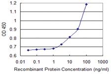 Anti-ALDH3B1 Mouse Monoclonal Antibody [clone: 1F2]