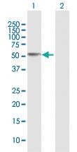 Anti-CCM2 Rabbit Polyclonal Antibody