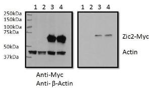 RWPE1 lysate (60ug protein in RIPA buffer) overexpressing Human ZIC2 with C-terminal MYC tag probed with Anti-ZIC2 Antibody (A83484) (0.5µg/ml) in the right panel and probed with anti-MYC Tag (1/1000) and anti-beta-Actin in the left panel