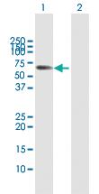 Anti-MPP2 Rabbit Polyclonal Antibody