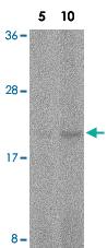 Anti-FAIM Rabbit Polyclonal Antibody