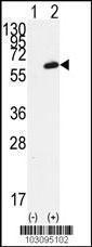 Anti-FGR Rabbit Polyclonal Antibody (AP (Alkaline Phosphatase))