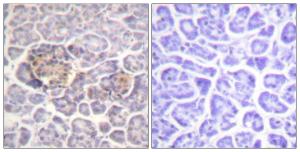 Immunohistochemical analysis of paraffin-embedded human pancreas tissue using Anti-Moesin Antibody. The right hand panel represents a negative control, where the antibody was pre-incubated with the immunising peptide.