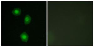 Immunofluorescence analysis of A549 cells using Anti-MSK1 Antibody. The right hand panel represents a negative control, where the antibody was pre-incubated with the immunising peptide.