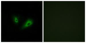 Immunofluorescence analysis of LOVO cells using Anti-OR10D4 Antibody. The right hand panel represents a negative control, where the antibody was pre-incubated with the immunising peptide.