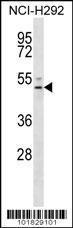 Anti-S1PR4 Rabbit Polyclonal Antibody (FITC (Fluorescein Isothiocyanate))