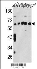 Anti-TMEM80 Rabbit Polyclonal Antibody