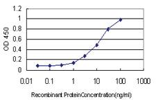 Anti-ALDH3B2 Mouse Monoclonal Antibody [clone: 3E6]